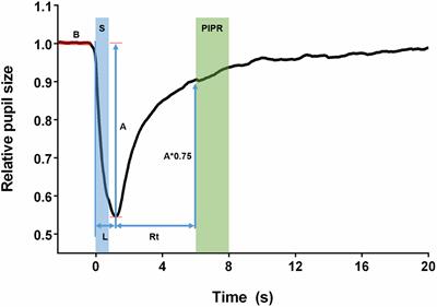 Alterations of color vision and pupillary light responses in age-related macular degeneration